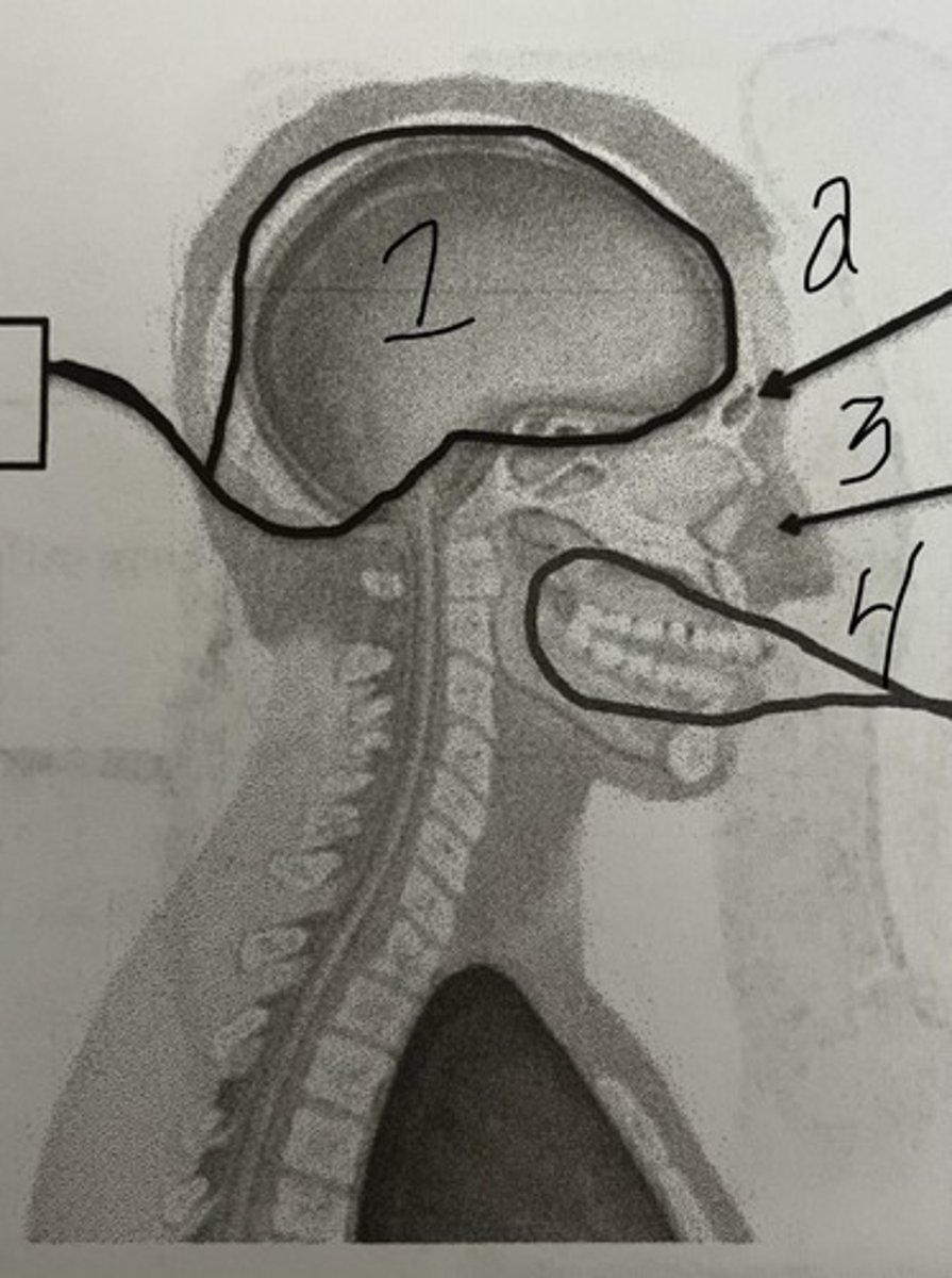 <p>What cavity does #1 represent?</p>