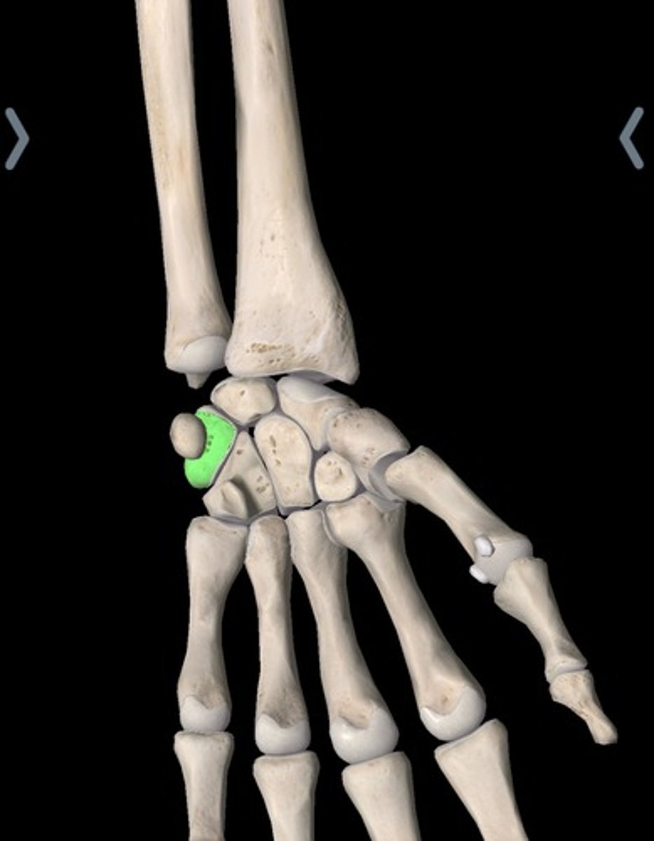 <p>Triquetrum of carpal</p>