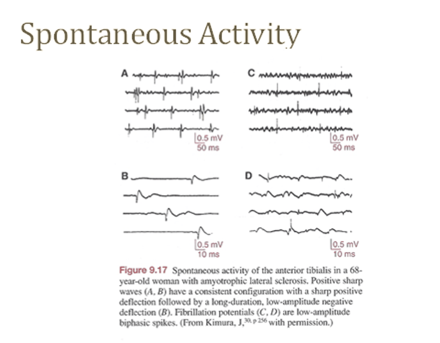 <p>See photo for examples</p><p>(in general is pathological)</p>