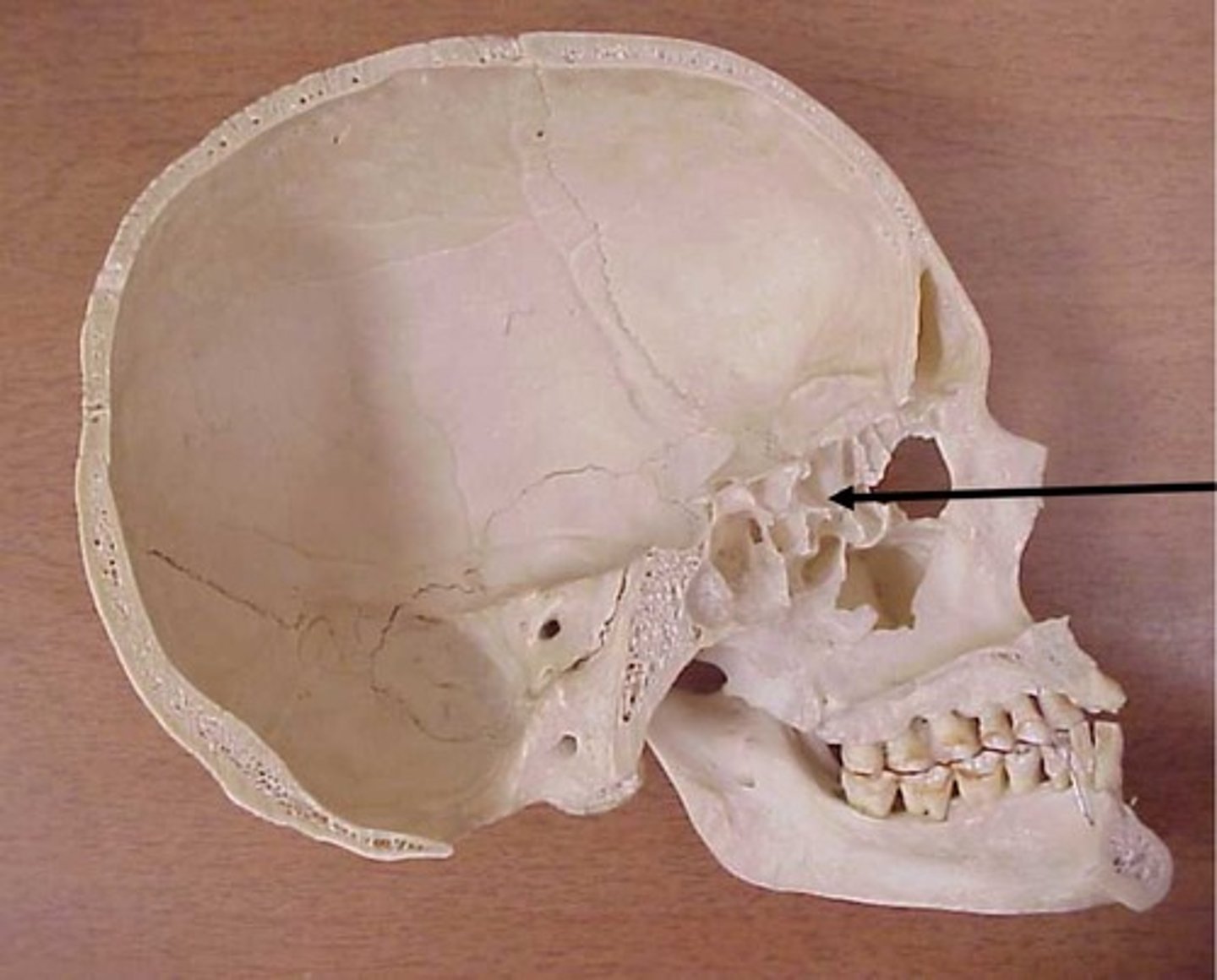 knowt flashcard image