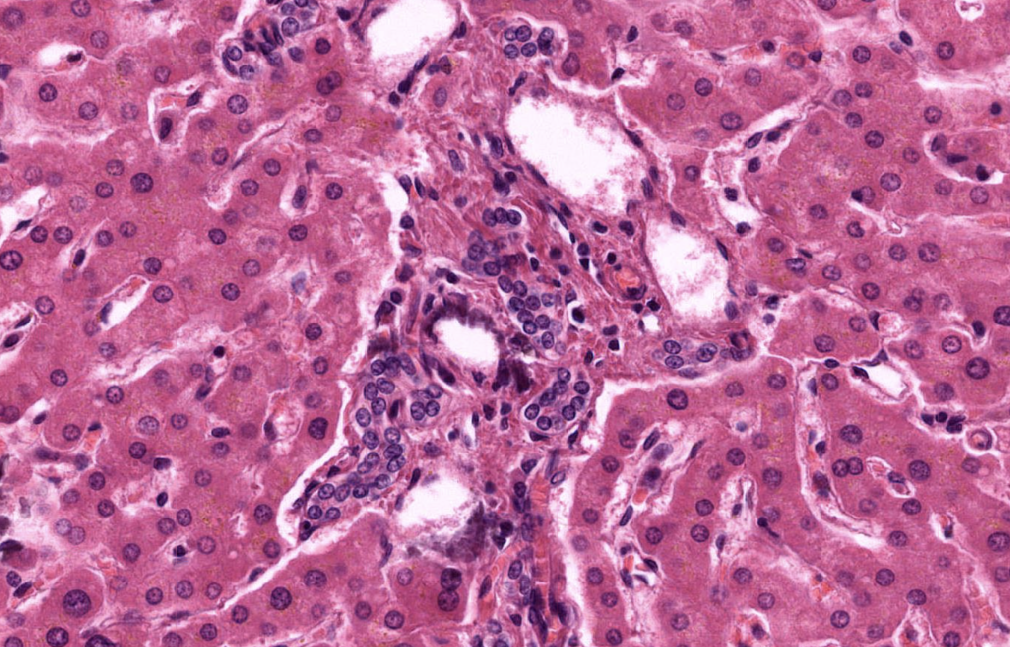 <p>Portal Vein in Liver</p>