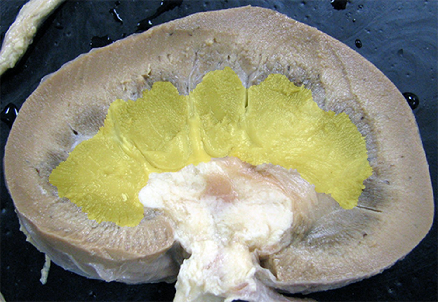 <p>-inner portion of kidney made of pyramids</p><p>-composed of collecting tubules that empty into the renal pelvis</p>