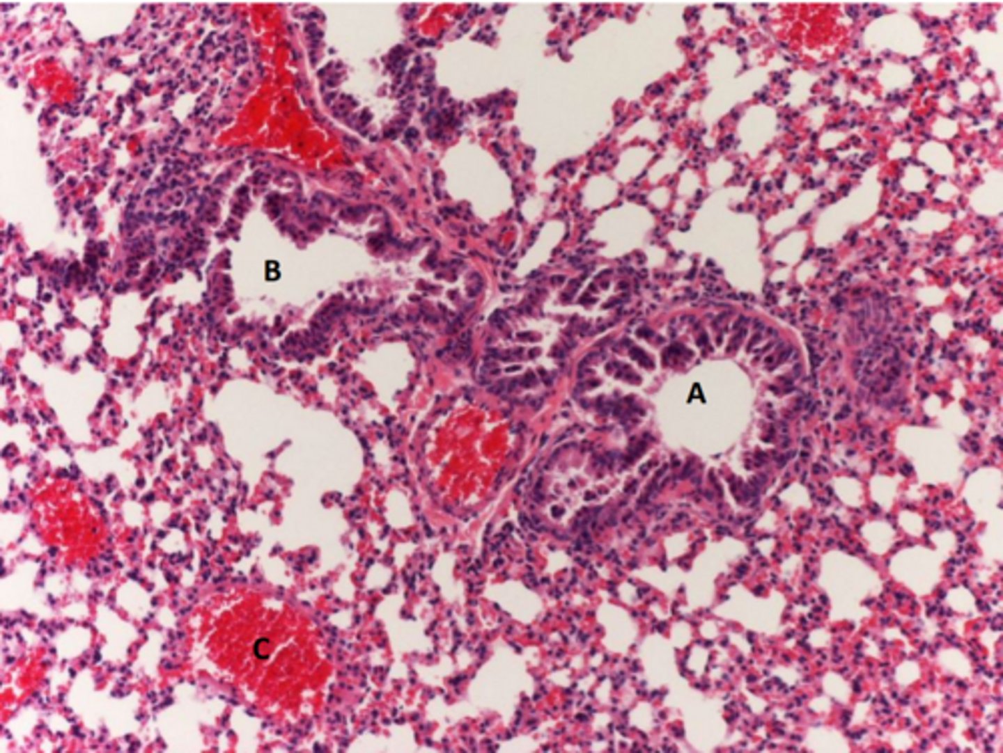 <p>organ</p>