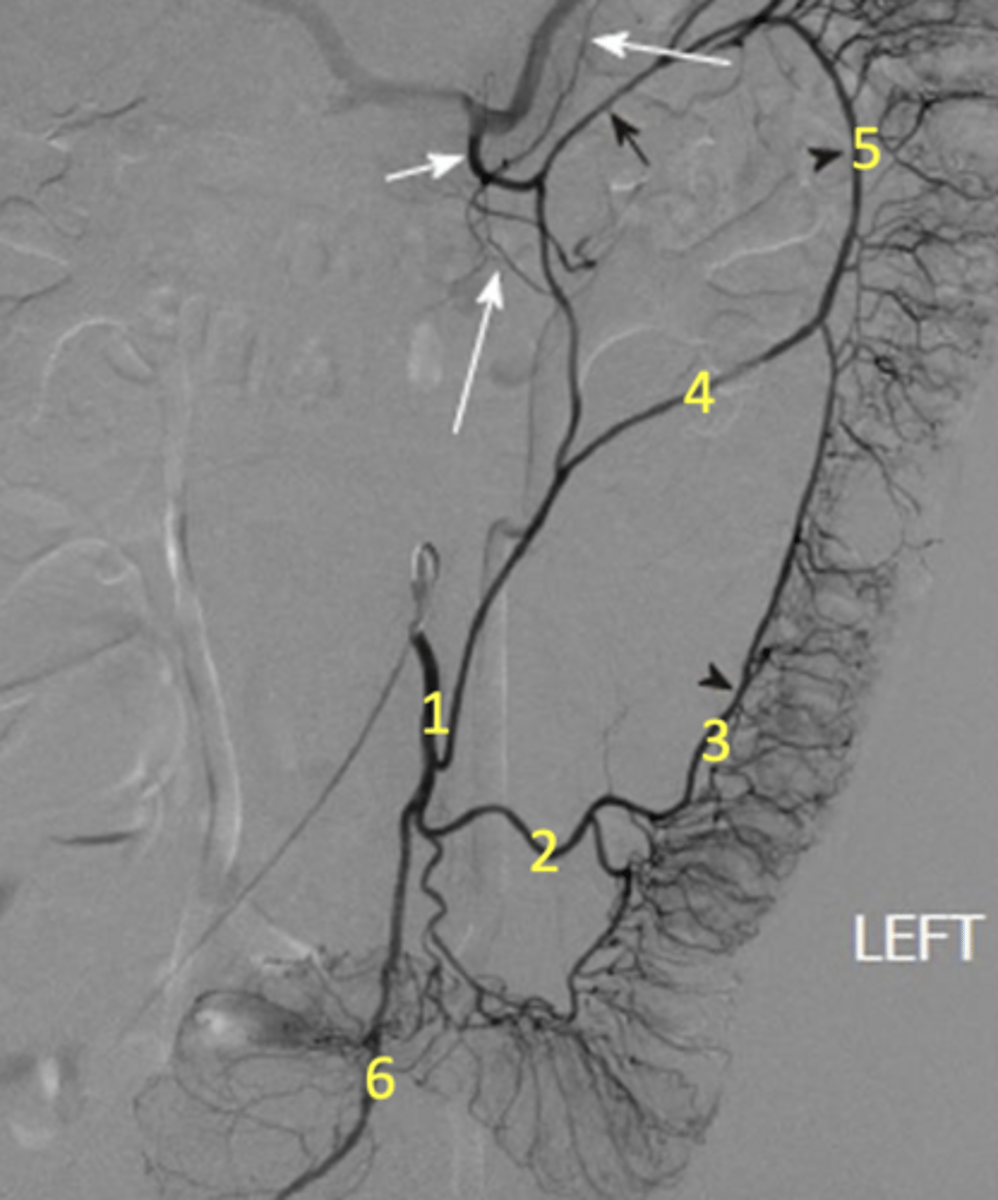 <p>Label the radiograph</p>
