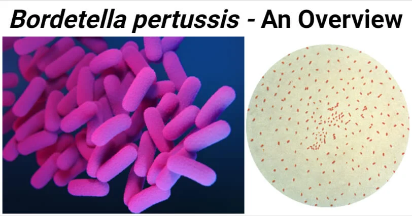 <p>True, bordetella pertussis is a gram negative rod</p>