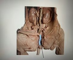 <p>What is the structure highlighted? What’s it function? </p>