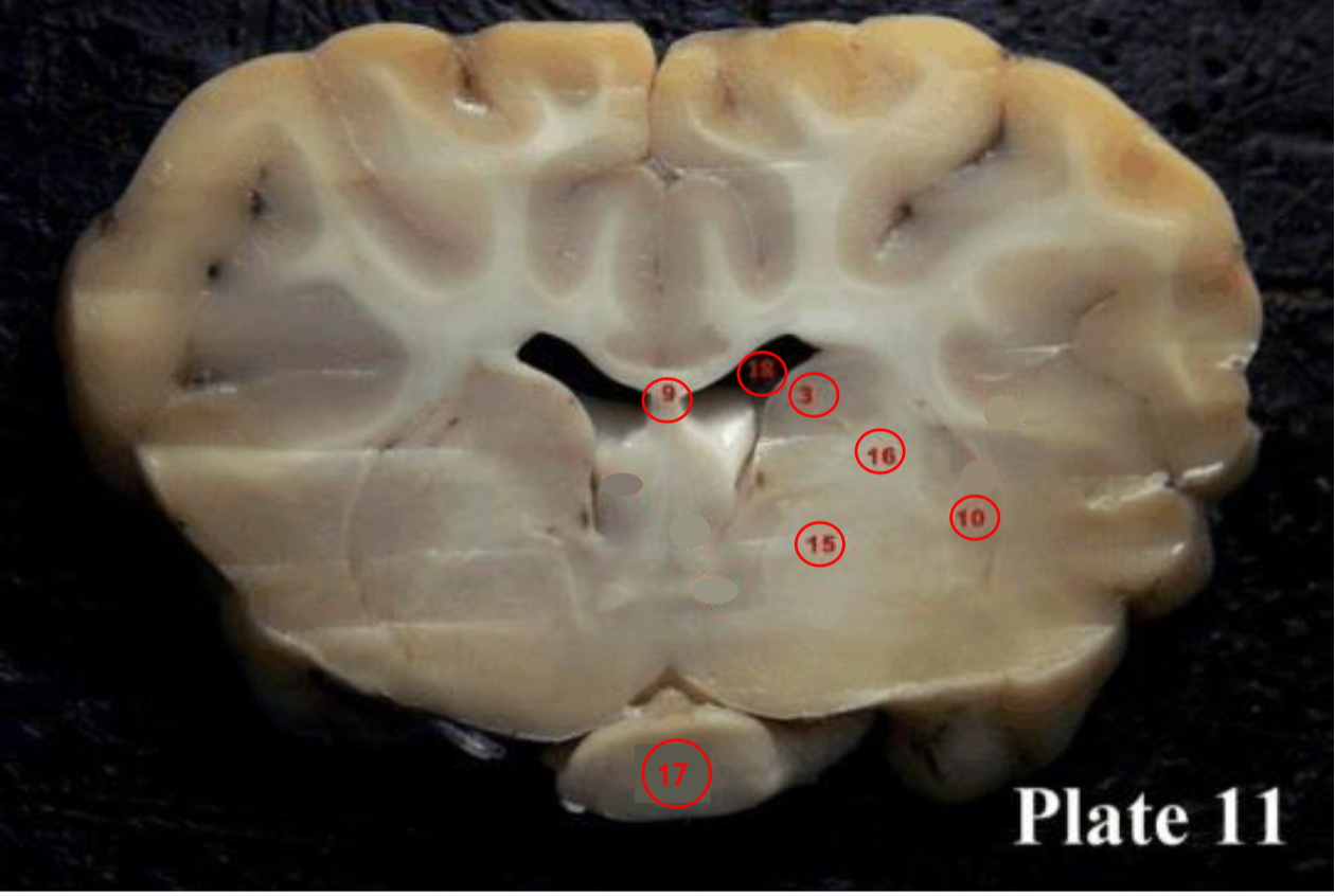 <p><span>lateral ventricles</span></p>