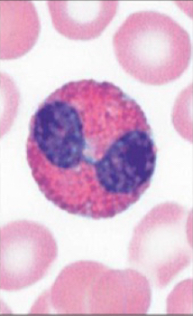 <p>Which cell is pictured?</p>