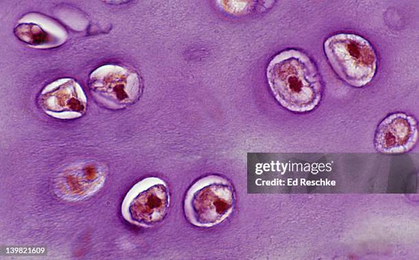 <p><strong>Picture example of hyaline cartilage tissue:</strong></p>