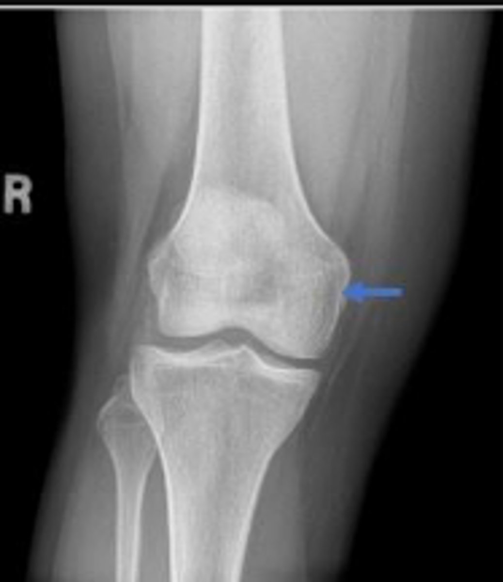 <p>What is the arrow pointing to?</p>