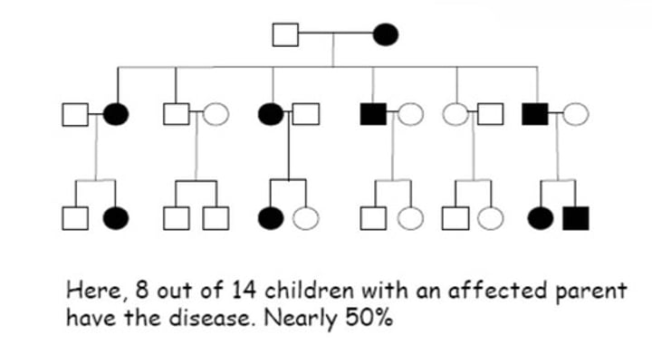 <p>- affected person usually has at least one affected parent<br>- affects either sex<br>- transmitted by either sex<br>- child of an unaffected x affected mating has 50% chance of disease (assuming affected parents are heterozygous)</p>