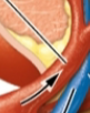 <p>what is this? (branches from renal artery) kidney</p>