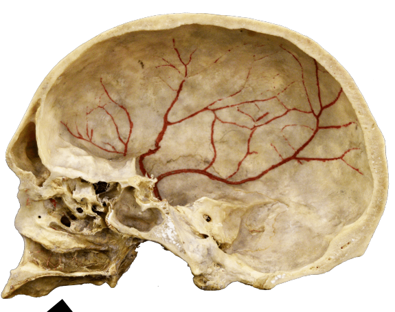 <p>branches of <span style="color: red">middle meningeal artery</span> travel deep to this spot</p>