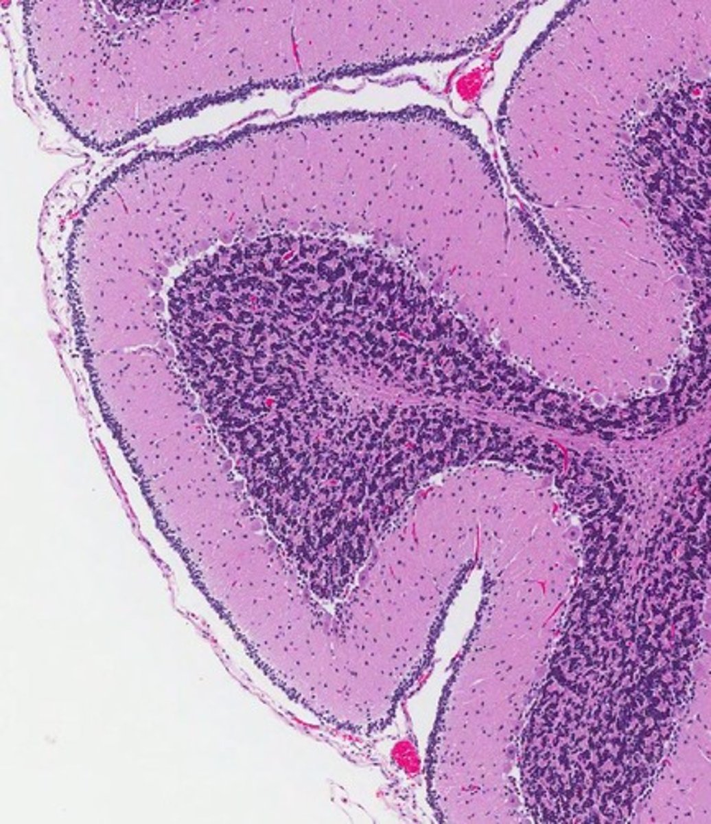 <p>The layers of the neonatal cerebellum include the External Granular Cell Layer, Molecular Layer, Purkinje Cell Layer, and Internal Granular Cell Layer.</p>