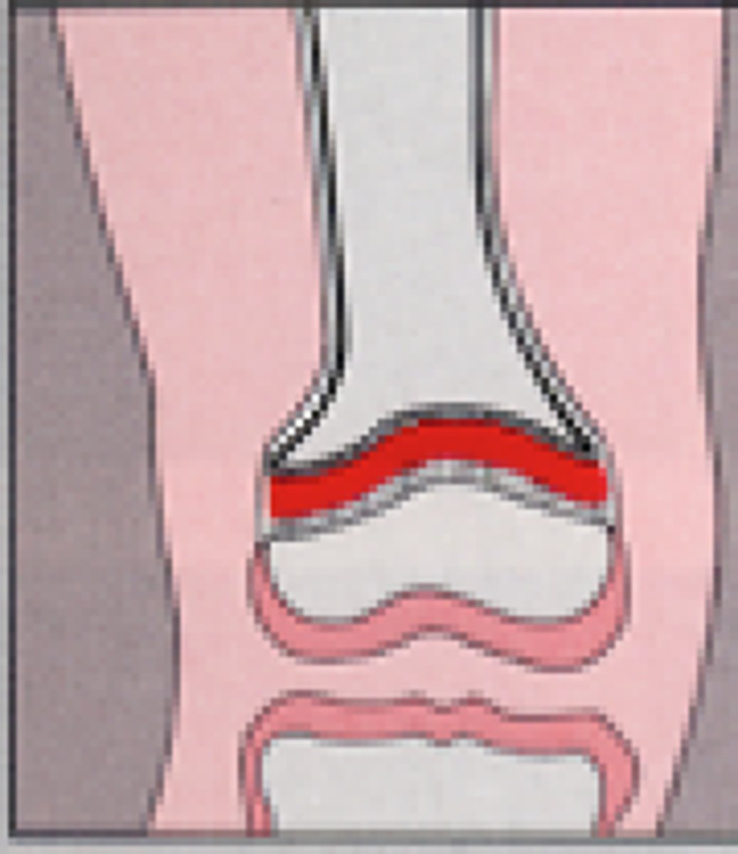 <p>forms between two ossification centers</p><p>band of hyaline cartilage</p><p>fuse together and growth stops when adult</p>