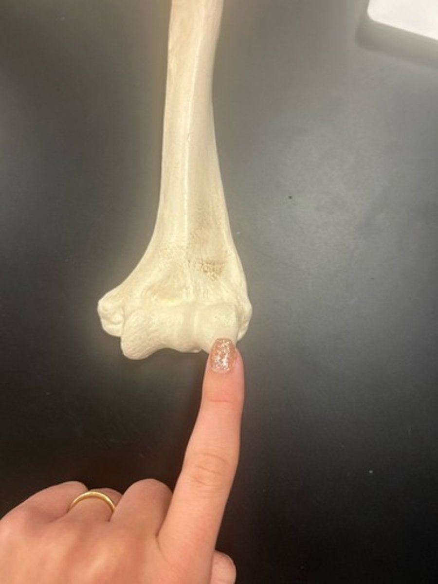 <p>name the bone</p>