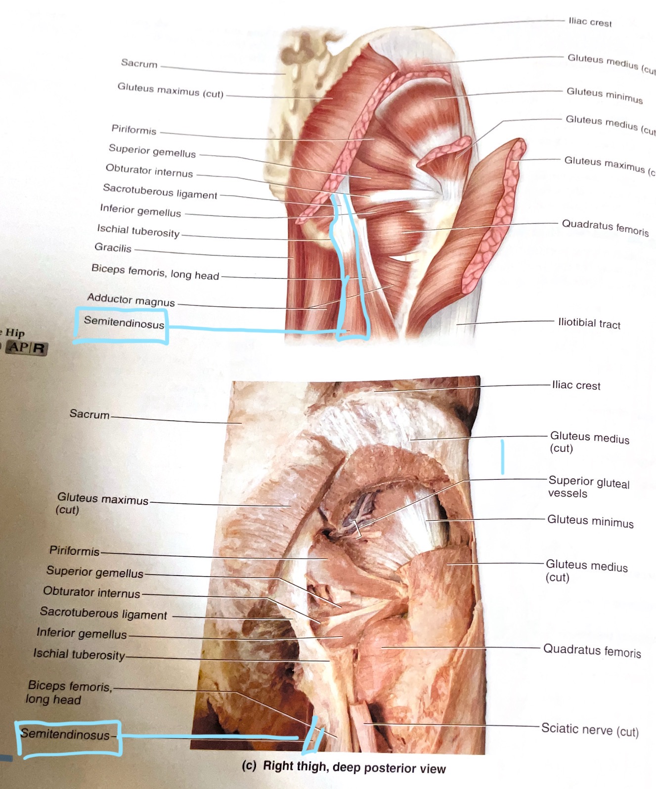 <p>Origin:Ischial tuberosity</p><p>Insertion:Proximal medial diaphysis of tibia </p><p>Action:Extend hip; flex knee</p>