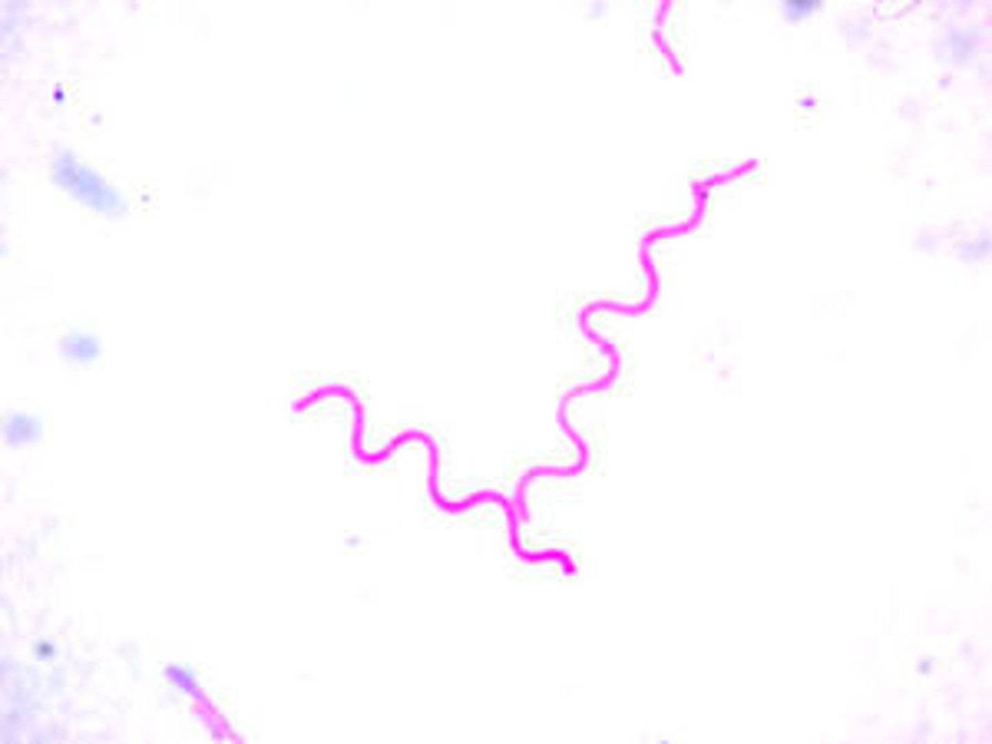 <p>spiral-shaped</p><p>moves by twisting themselves like corkscrews and some have flagella</p><p>ex. Treponema Pallidumcholera (syphilis) and Borrelia Burgdoferi (Lyme disease)</p>