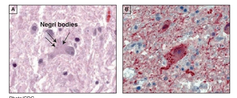 <p>Rhabdovirus</p>