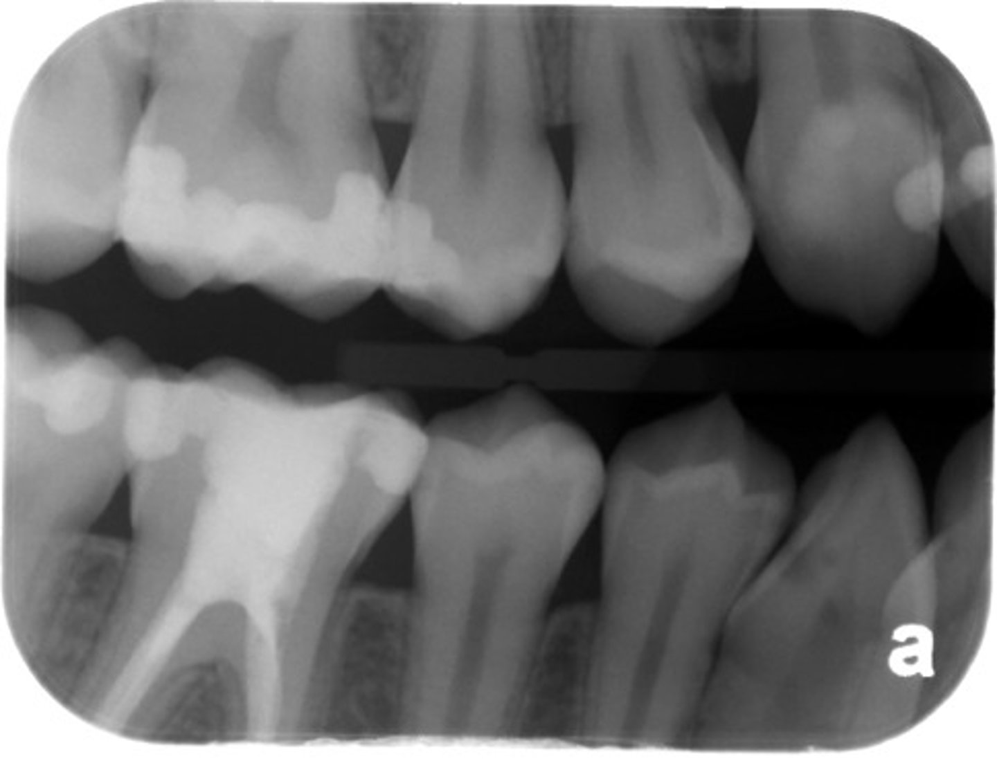 <p>Result of incorrect horizontal angualtion</p>