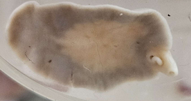 <p><span data-name="microscope" data-type="emoji">🔬</span><span data-name="petri_dish" data-type="emoji">🧫</span><strong><span> </span>Na podstawie zdjęcia preparatu:</strong></p><p></p><ul><li><p><span data-name="book" data-type="emoji">📖</span><span> </span>rozpoznaj gatunek pasożyta;</p></li></ul><p></p><ul><li><p><span data-name="recycle" data-type="emoji">♻</span><span> </span>rozpoznaj wszystkie formy rozwojowe;</p></li></ul><p></p><ul><li><p><span data-name="microbe" data-type="emoji">🦠</span><span> </span>wskaż organelle i cechy charakterystyczne dla danego gatunku;</p></li></ul><p></p><ul><li><p><span data-name="mask" data-type="emoji">😷</span><span> </span>nazwij chorobę, którą pasożyt wywołuje.</p></li></ul><p></p>