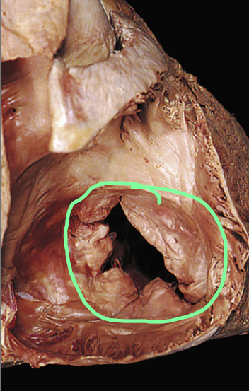 <p>What is circled in green?</p>