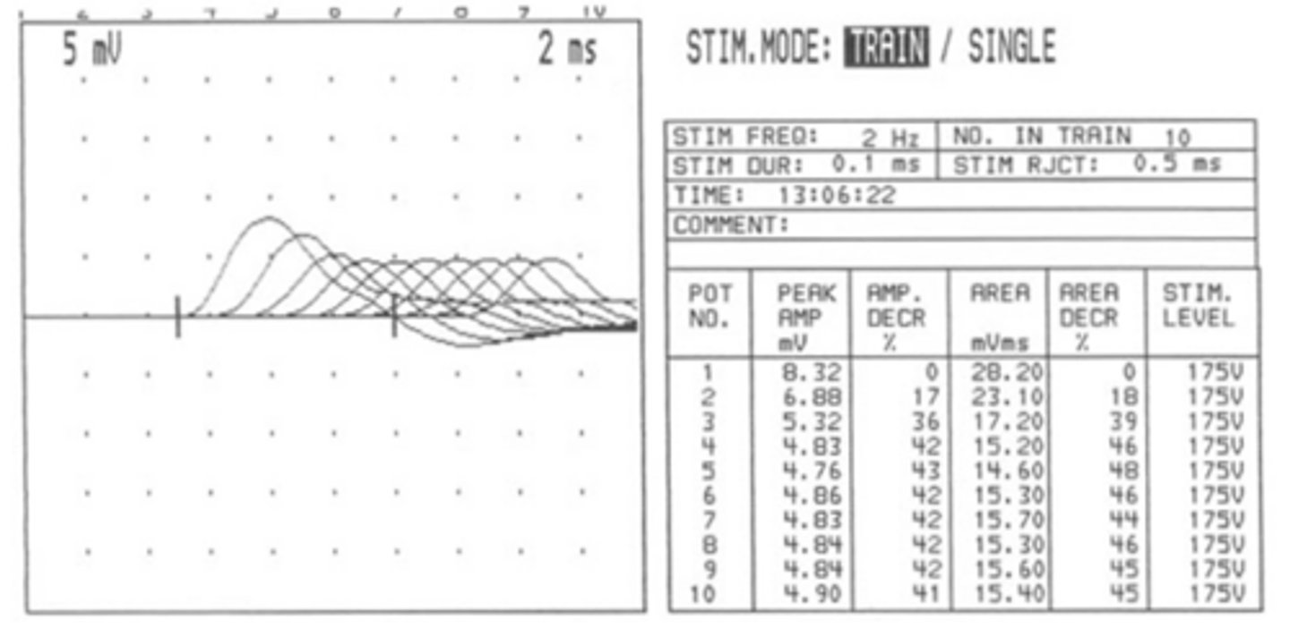 <p>Electromyography (EMG) with Repetitive nerve stimulation (RNS) showing decrement</p>
