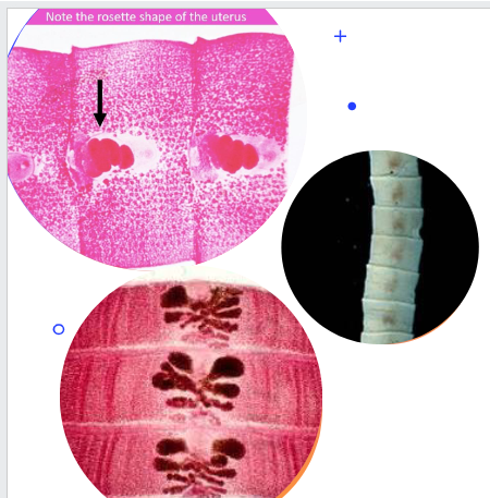 <ul><li><p><span>Wider than they are long</span></p></li><li><p><span><u>Rosette uterus</u></span></p></li></ul><p></p>