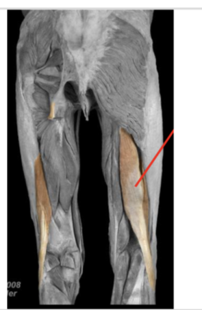 <p>biceps femoris (long head)</p>