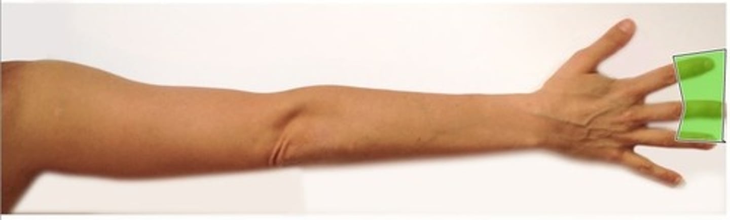 <p>palm of hand</p><p>ventral region of thumb</p><p>Distal portions of index, middle and medial half of ring finger</p>