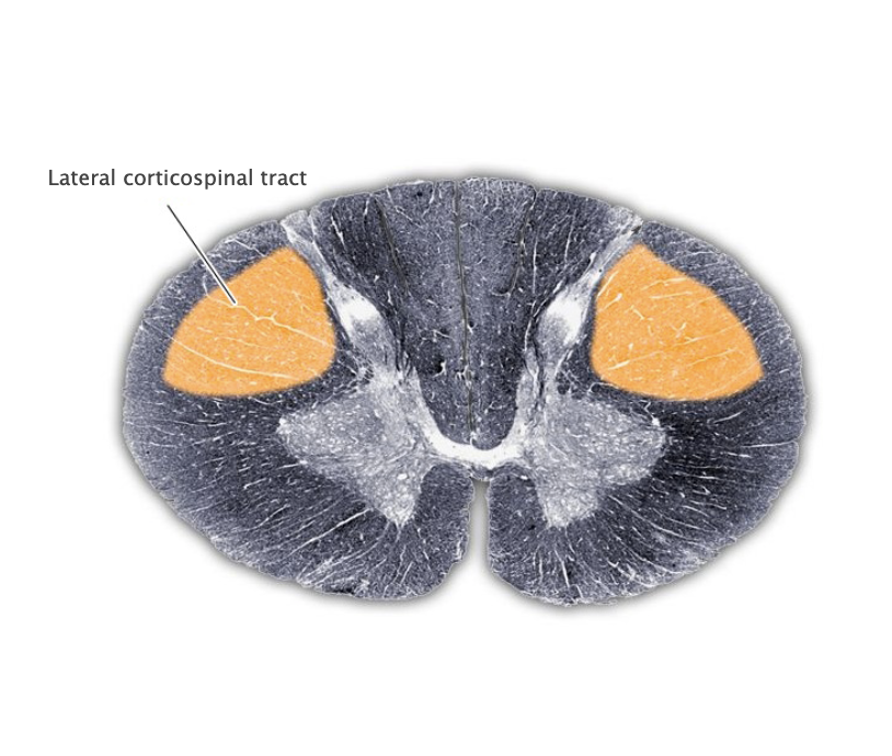<p>Lateral corticospinal tract</p>