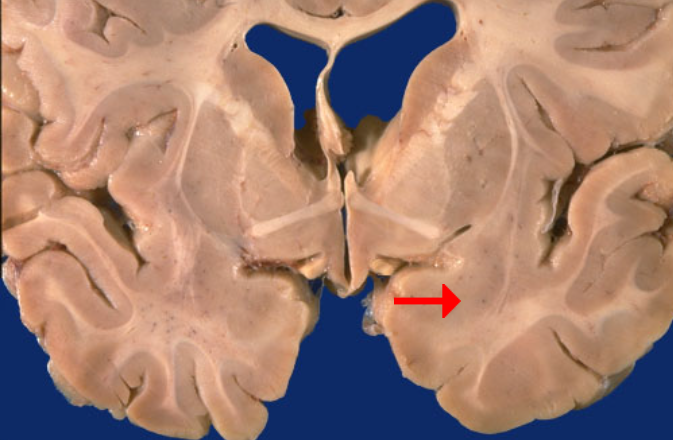 <p>Label this brain structure</p>