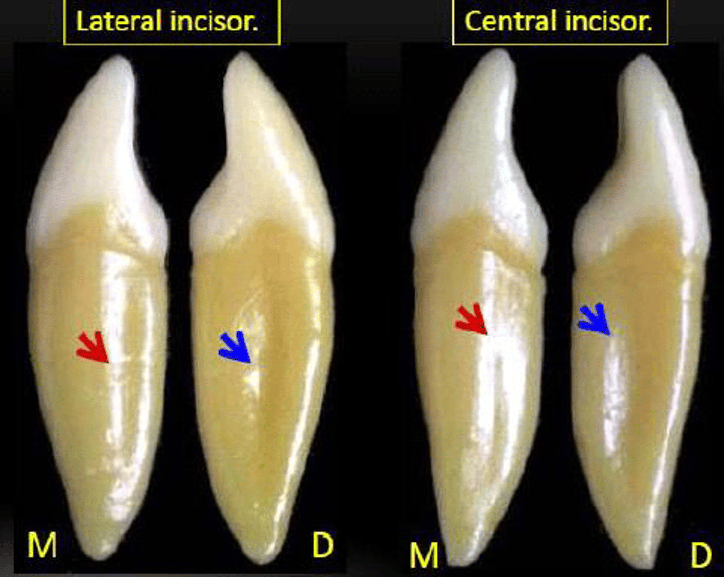 <p>lateral vs central mandibular incisors</p>