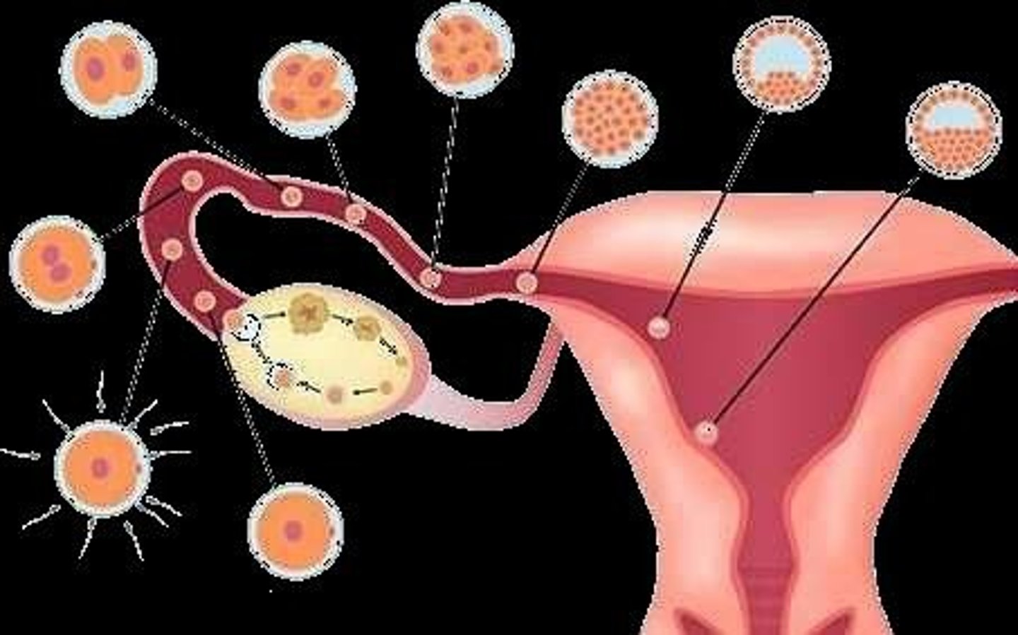<p>The Graafian follicle bursts to release an ovum (ovulation).</p>