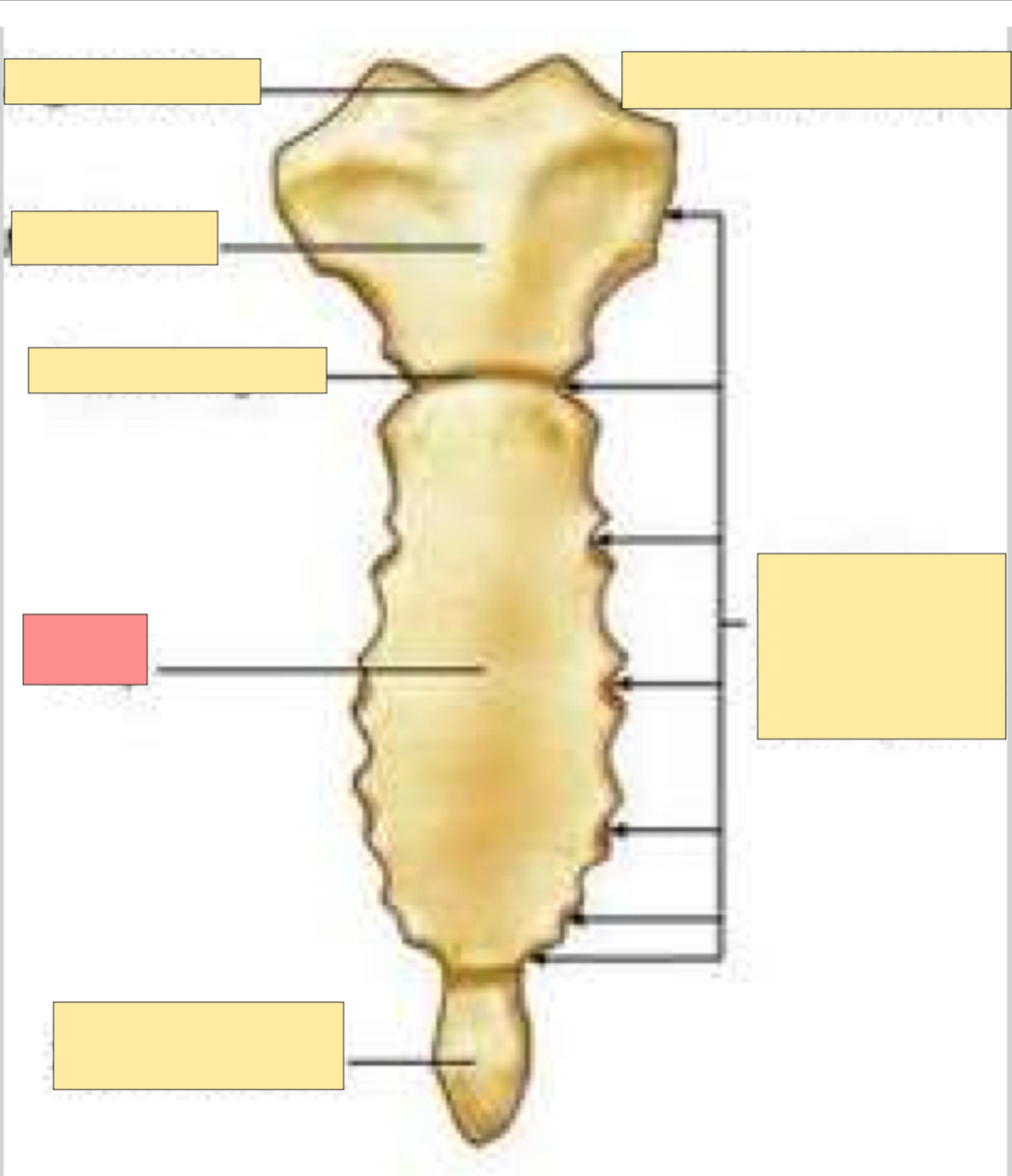 <p>What part of the sternum is this?</p>