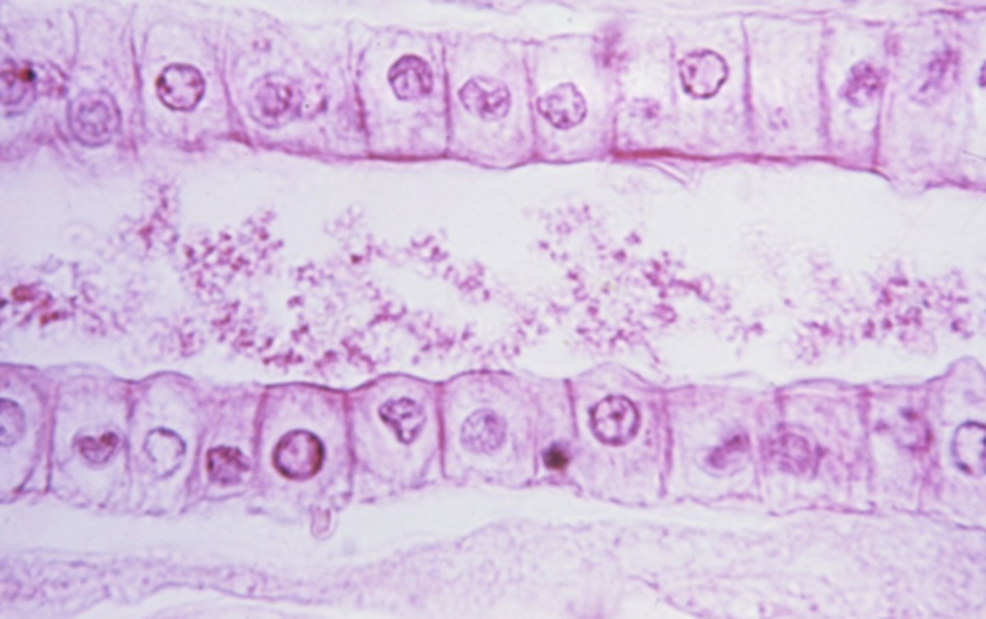 <p>what type of epithelium is this</p>