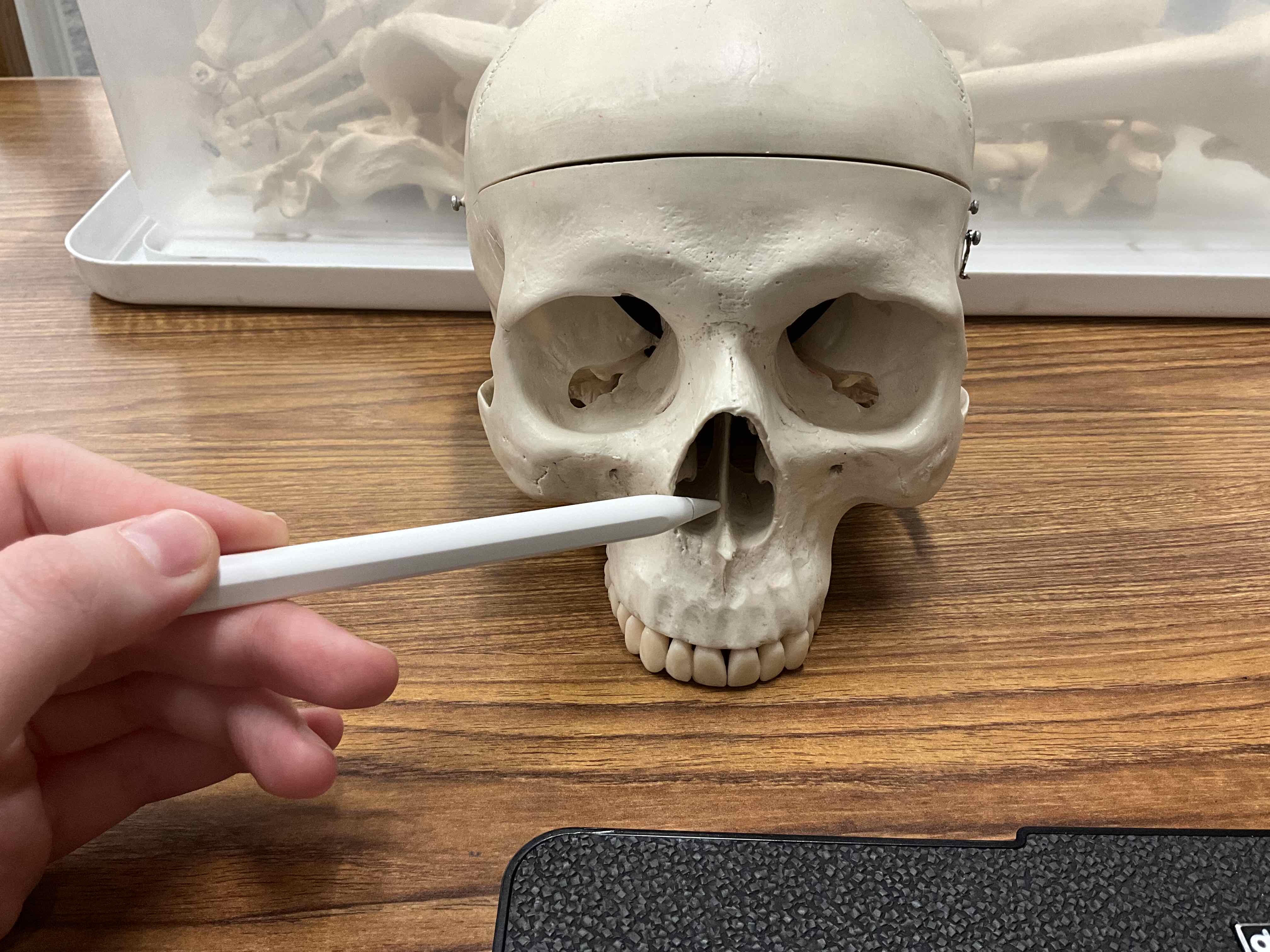 <p>Name the bone</p>