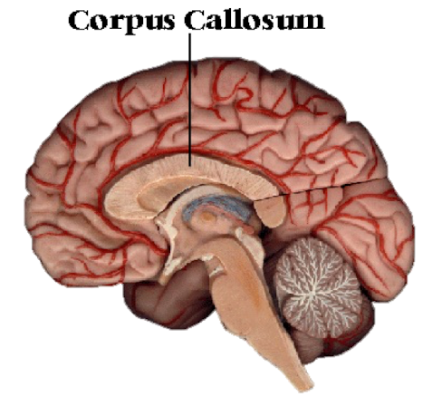 <p>bundle of axons that interconnects two cerebral hemispheres</p>