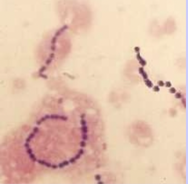 Gram stained slides of… 