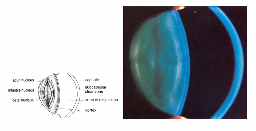 <p>lens fibre zones in vivo </p>