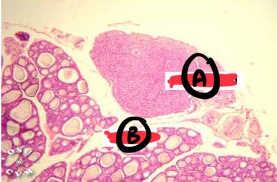<p>A</p>