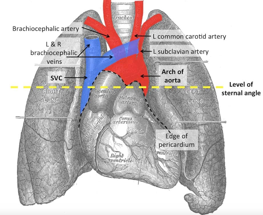 <p>The lower boundary of mediastinum superius is the plane between angulus sterni and Th4/Th5.</p><p><strong><mark data-color="red" style="background-color: red; color: inherit">A. Yes</mark></strong></p><p>B. No</p>