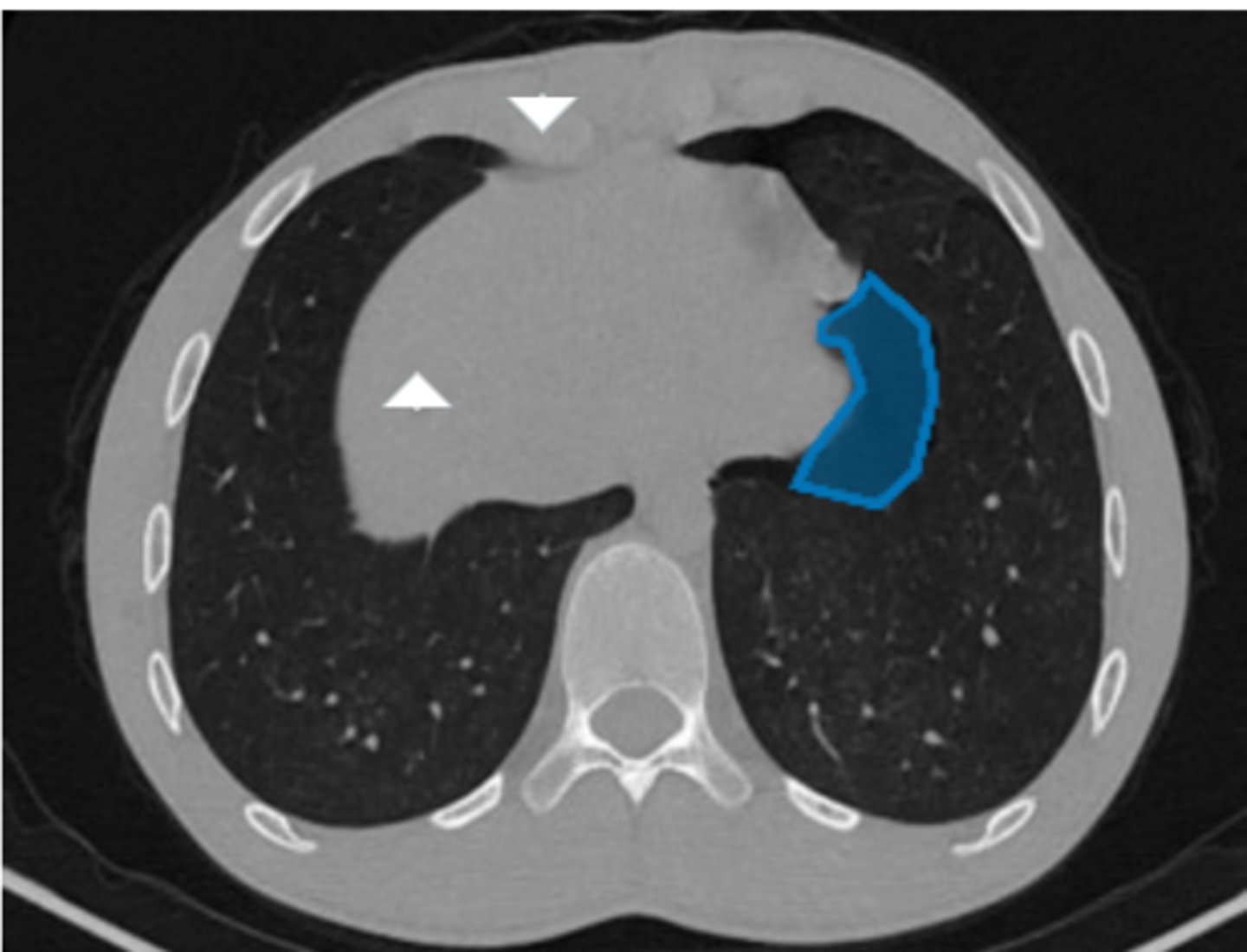 <p>Label pathology in image below</p>
