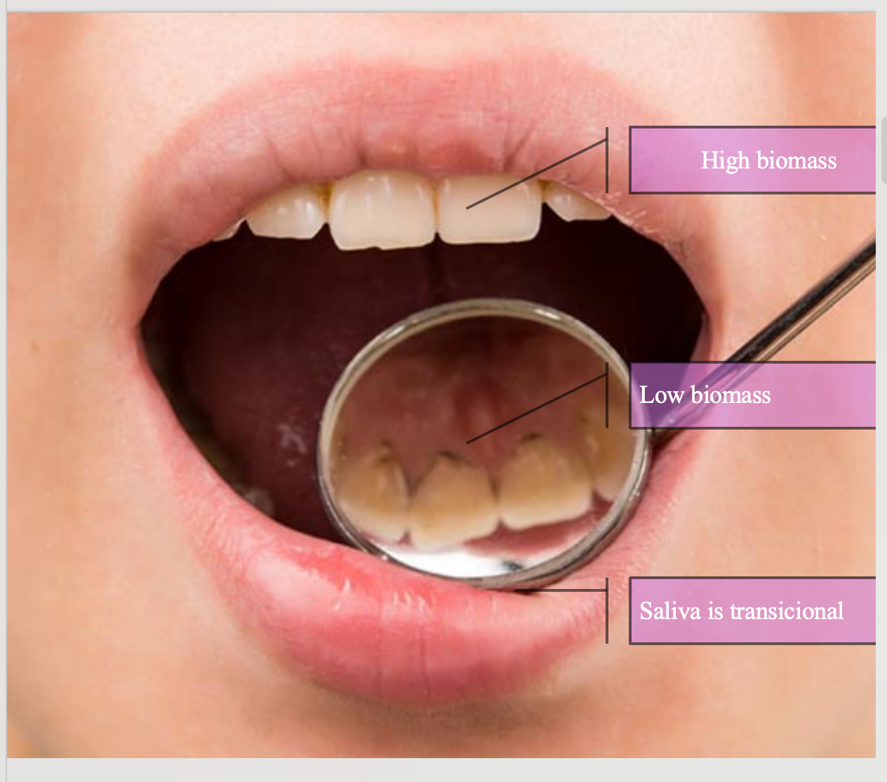 <p>High biomass sites</p><p>Non-shedding surfaces</p><p>Supragingival tooth surfaces</p><p>Subgingival tooth surfaces</p><p>Shedding surface</p><p>The tongue: reservoir for anaerobic bacteria</p><p>Low biomass sites</p><p>Shedding oral mucosa surfaces </p><p>Saliva as a transitional zone</p>