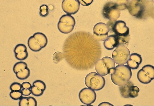 <p>Calcium carbonate</p>