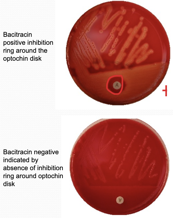 <p>Bacitracin Sensitivity Test positive vs negative </p>