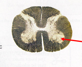 <p>Which spinal cord segment?</p>