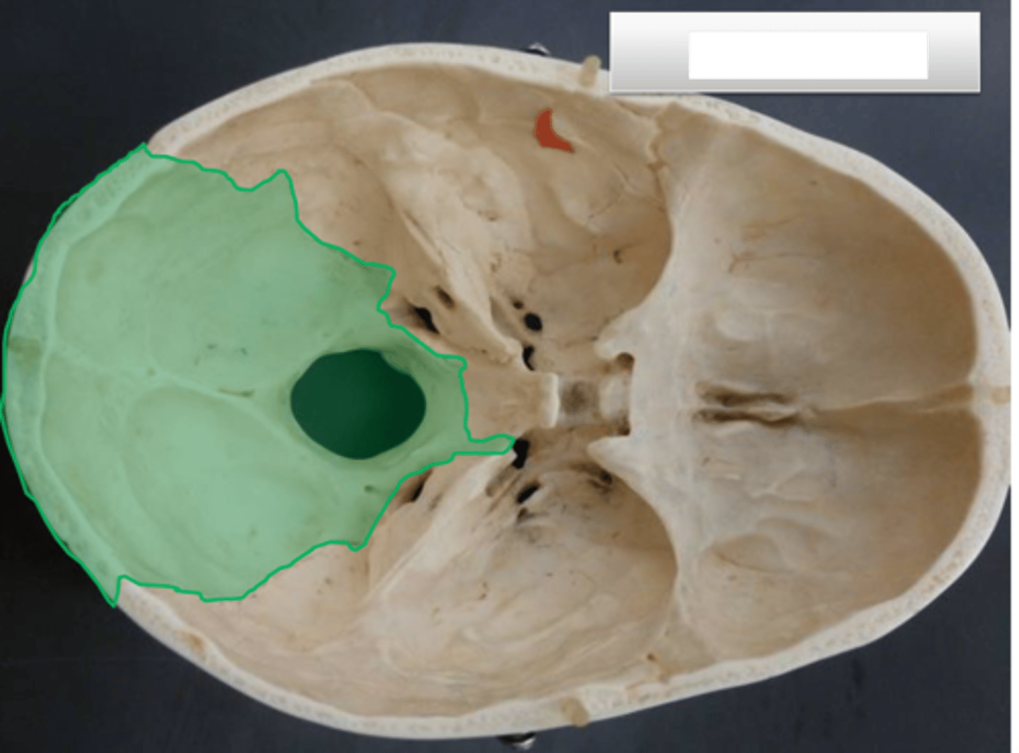 <p>green highlighted</p>