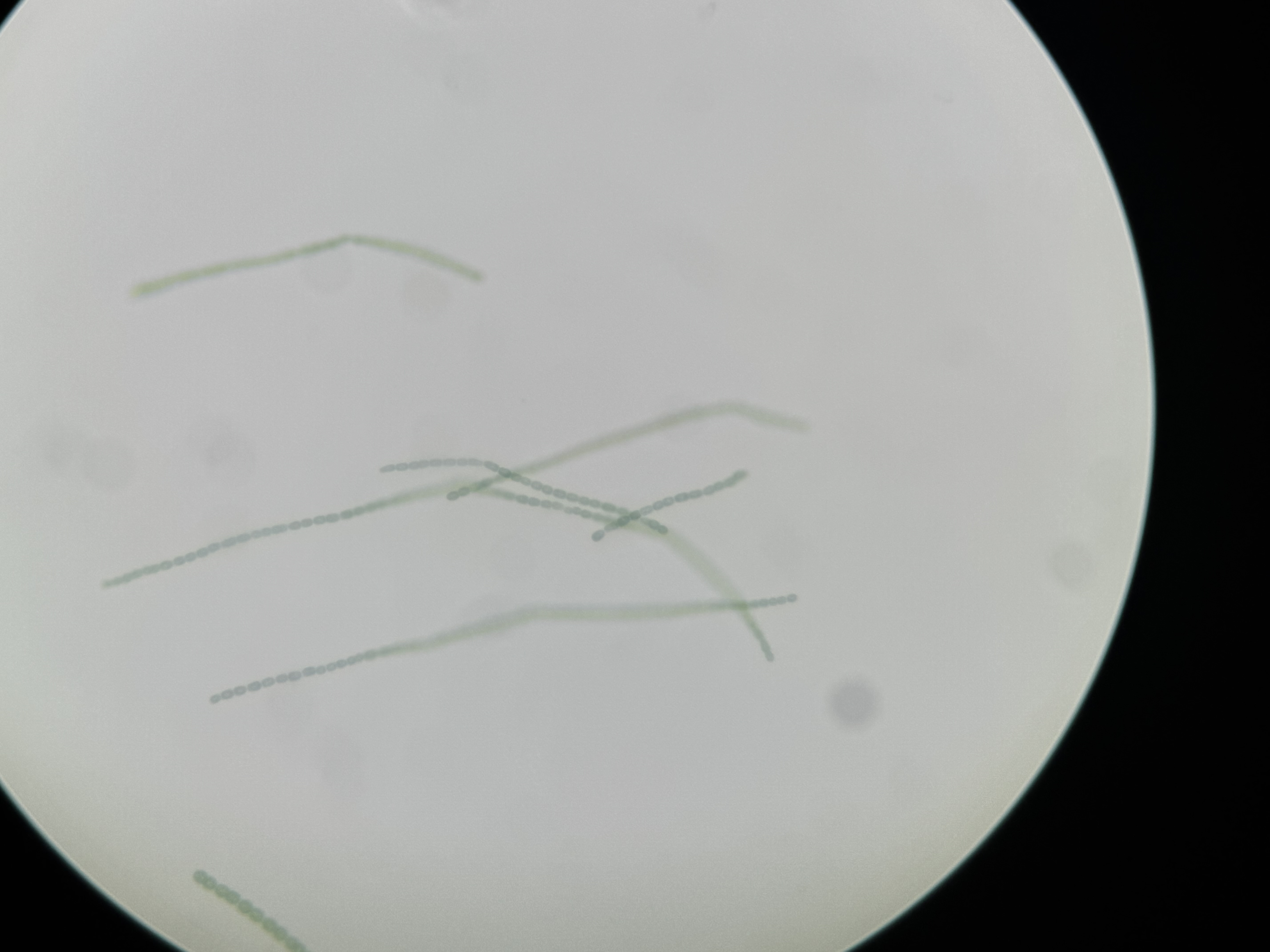 <p>Anabaena</p>