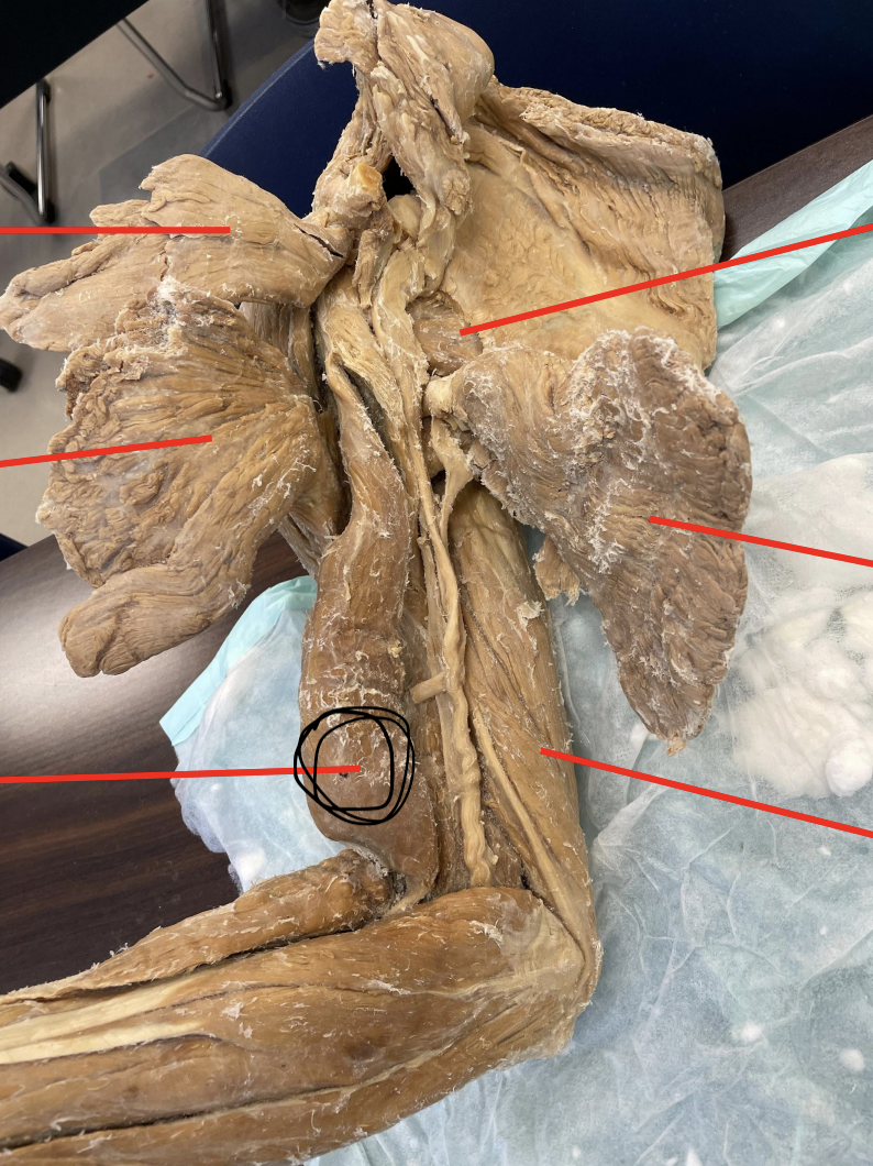 <p>identify + state origin, insertion, action, innervation of marked structure</p>